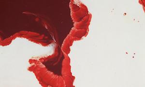 Unclean-Group exhibition Somos Arts